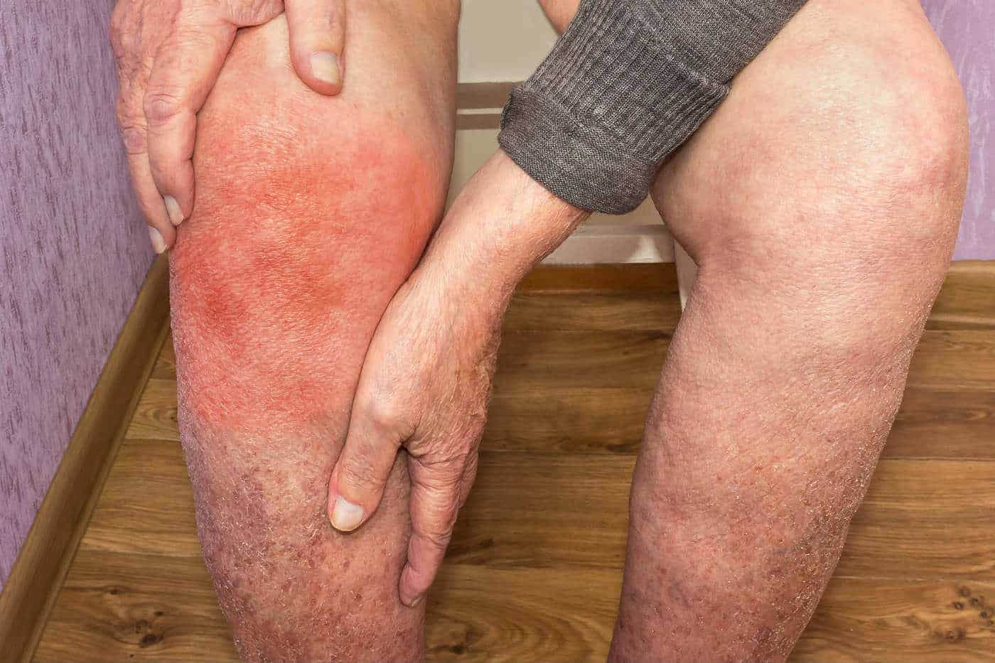 Best Cream For Knee Pain