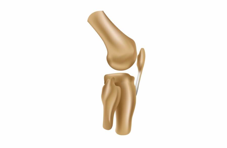 hip replacement recovery time for elderly